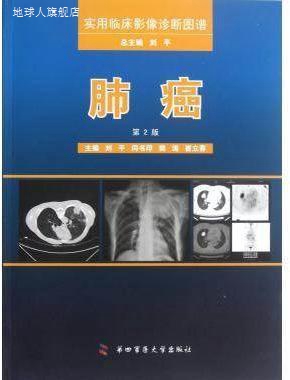 肺癌  第2版,刘平等主编,第四军医大学出版社,9787566202802