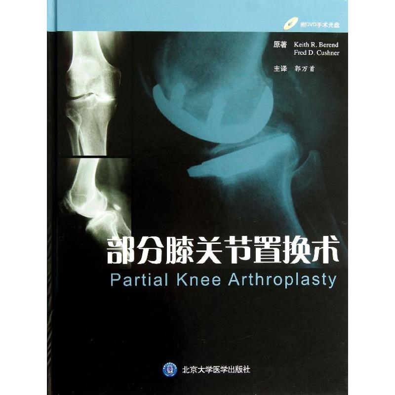 部分膝关节置换术 贝伦德 北京大学医学出版社9787565905995   赠光盘