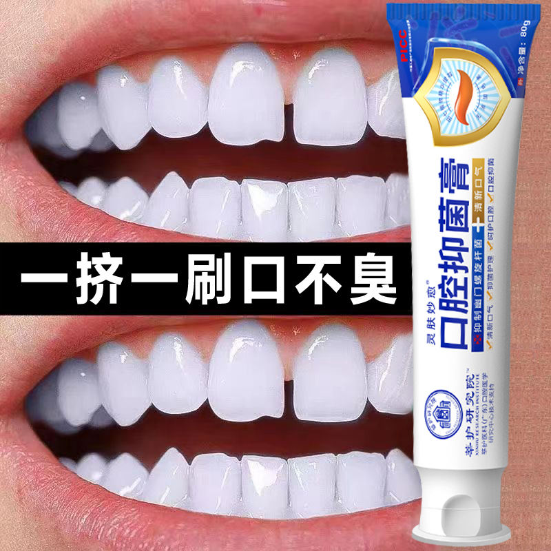 除口臭牙膏亮白焕白去黄去清洁牙渍口气清新口腔抑菌牙膏 正品